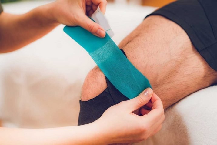 The Kinesiology Tape