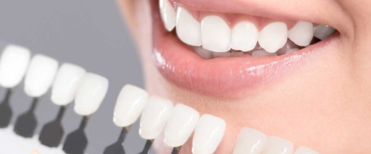 Cosmetic Dentist Procedures