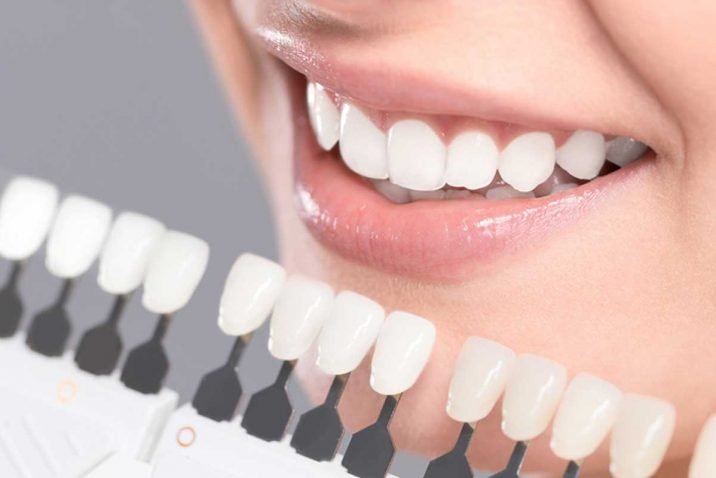 Cosmetic Dentist Procedures