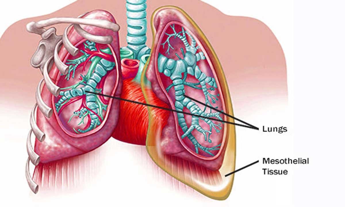 Know About Mesothelioma