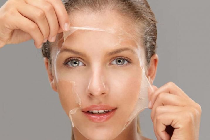 How to Choose the Right Clinic for Chemical Facial Peels in San Diego