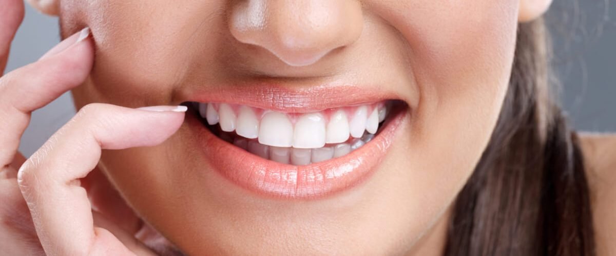 Do Porcelain Veneers Ruin Your Teeth