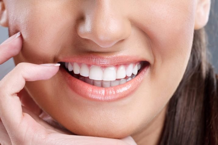 Do Porcelain Veneers Ruin Your Teeth