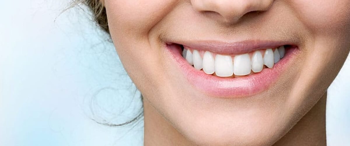 How Durable Are Porcelain Veneers