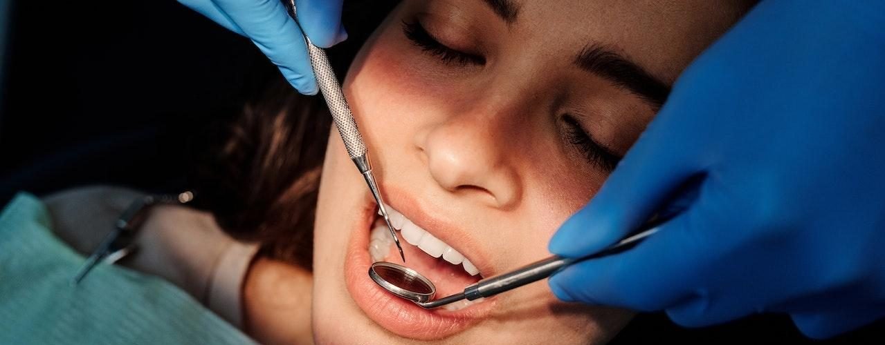 Top 5 Reasons Why Veneers Prices Are Worth the Investment 2