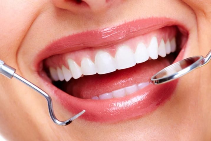 Cosmetic Dentistry Procedures