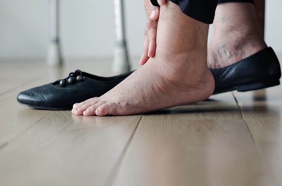 7 Causes for Swollen Feet and Ankles