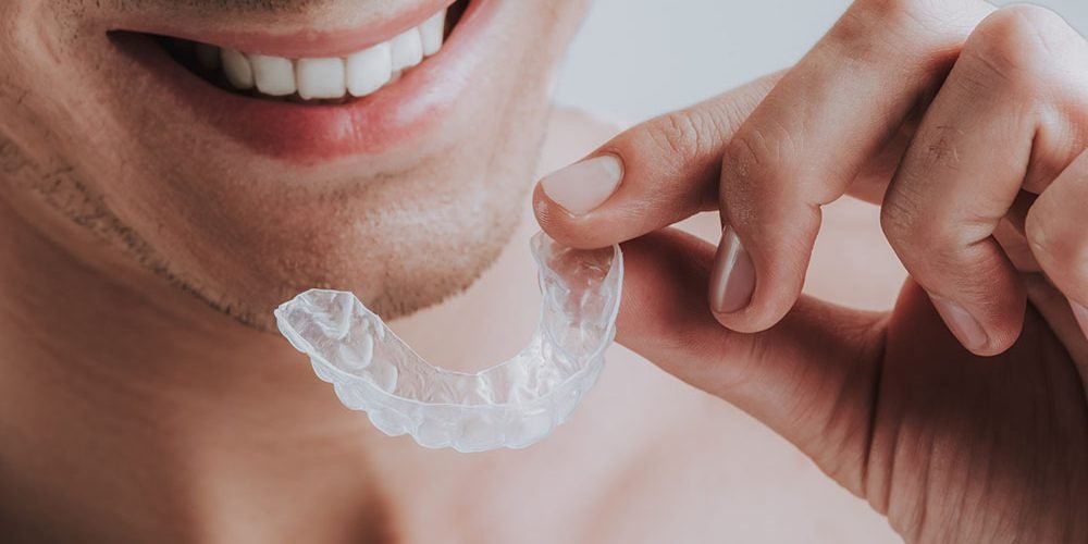 Close up of smiling man holding transparent mouth guard