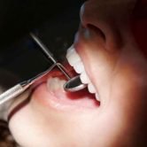 Everyday Habits That Can Improve Your Dental Health