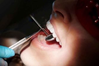 Everyday Habits That Can Improve Your Dental Health