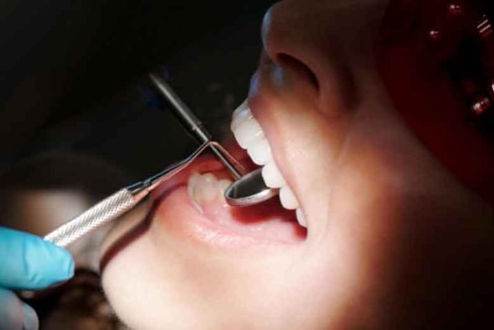 Everyday Habits That Can Improve Your Dental Health