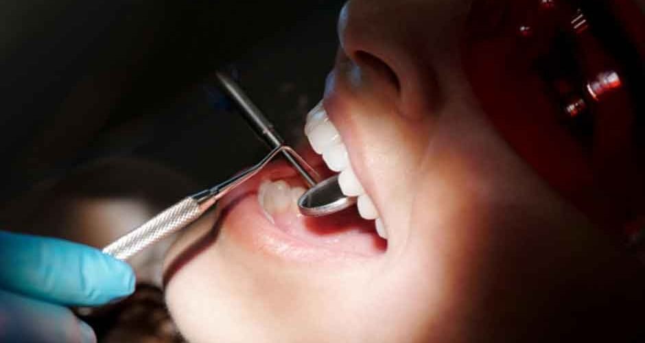 Everyday Habits That Can Improve Your Dental Health